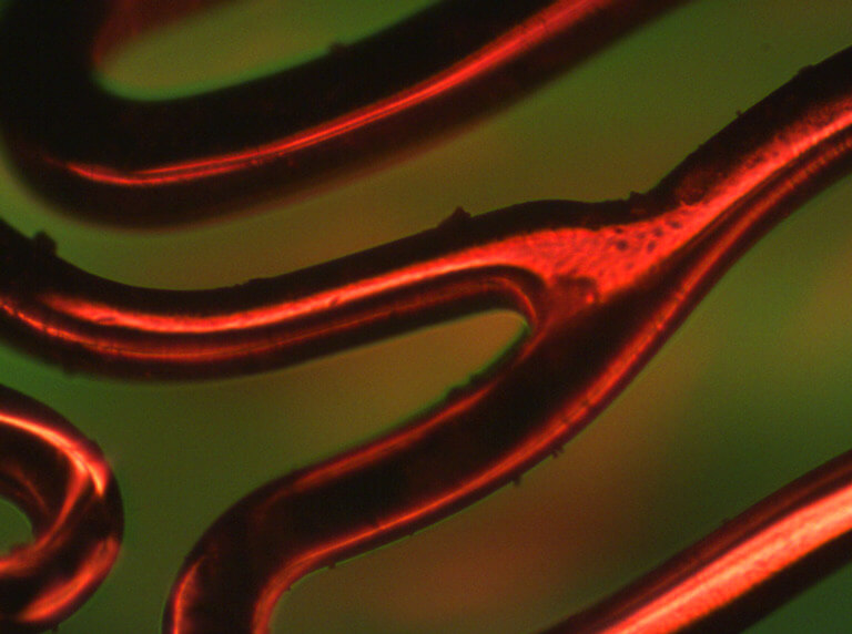medical stent showing burrs