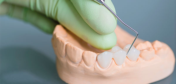 Herramienta de mano trabajando en molde dental